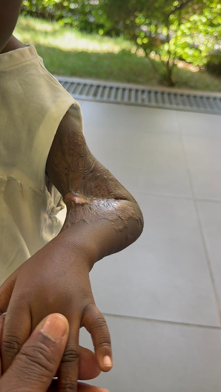 Criança atendida pela Jucarente